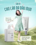 Giải bí cho làn da dầu mụn