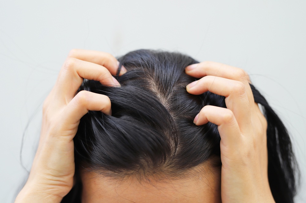 gội đầu xong bị ngứa da đầu nguyên nhân và cách gội đúng